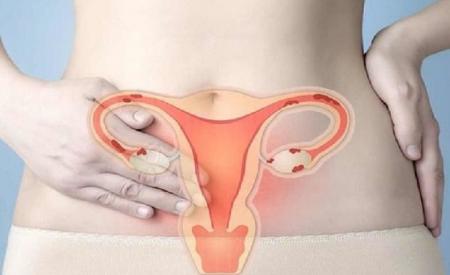 Ung thư cổ tử cung có di truyền không?